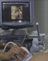 ultrasound